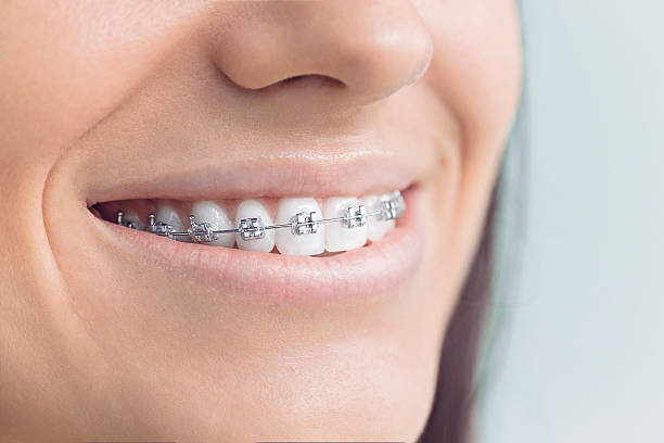 Best Teeth Whitening  in Midland, TX